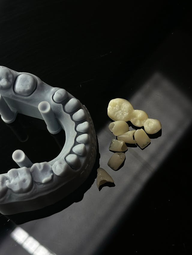 Dental Crowns - Strengthen weak teeth with custom crowns at Dr. Dentium Dental Clinic