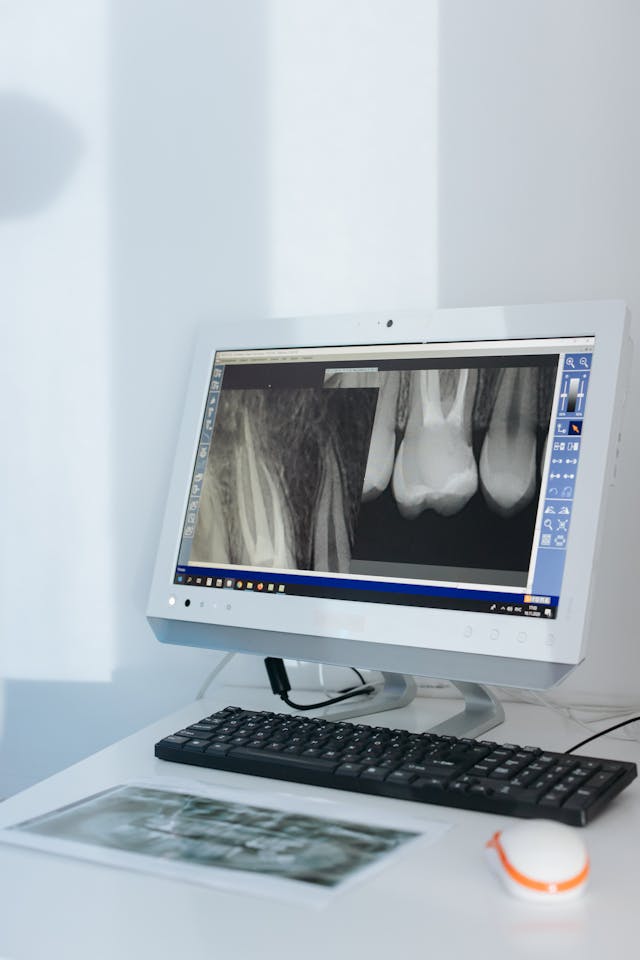 Dental X-Rays and Imaging - Accurate diagnosis with digital imaging at Dr. Dentium Dental Clinic